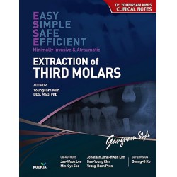 NEW Extraction of Third Molars : Easy Simple Safe Efficient Minimally Invasive & Atraumatic